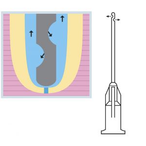 Cannule d'irrigazione 2 bocche Ø 0.3mmx25mm (x25)